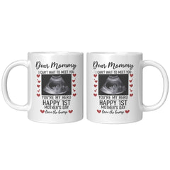 Personalized Mothers Day Sonogram Mug Upload Your Custom Sonogram Coffee Cup 11oz 15oz White